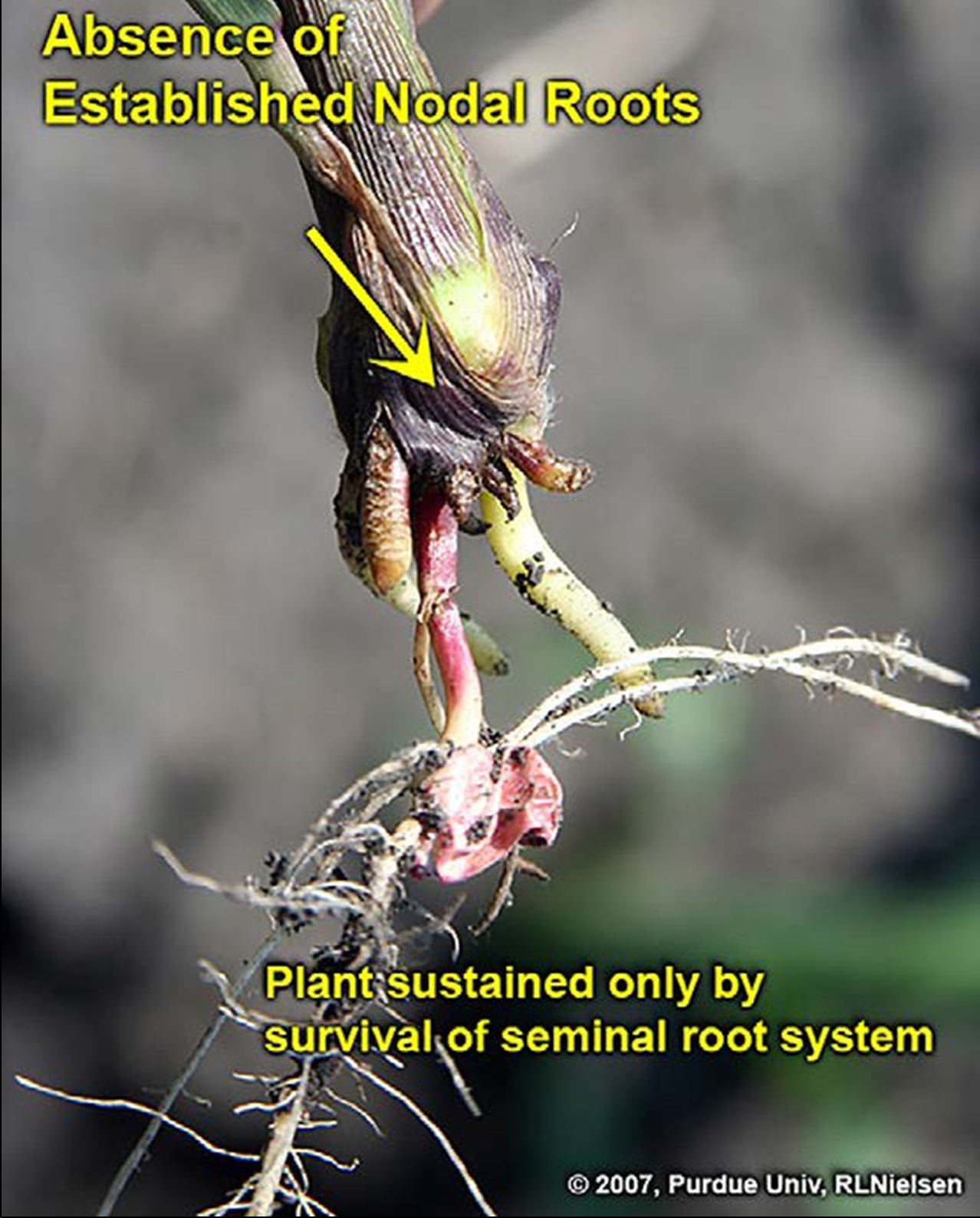 absence of established nodal roots absence of established nodal roots